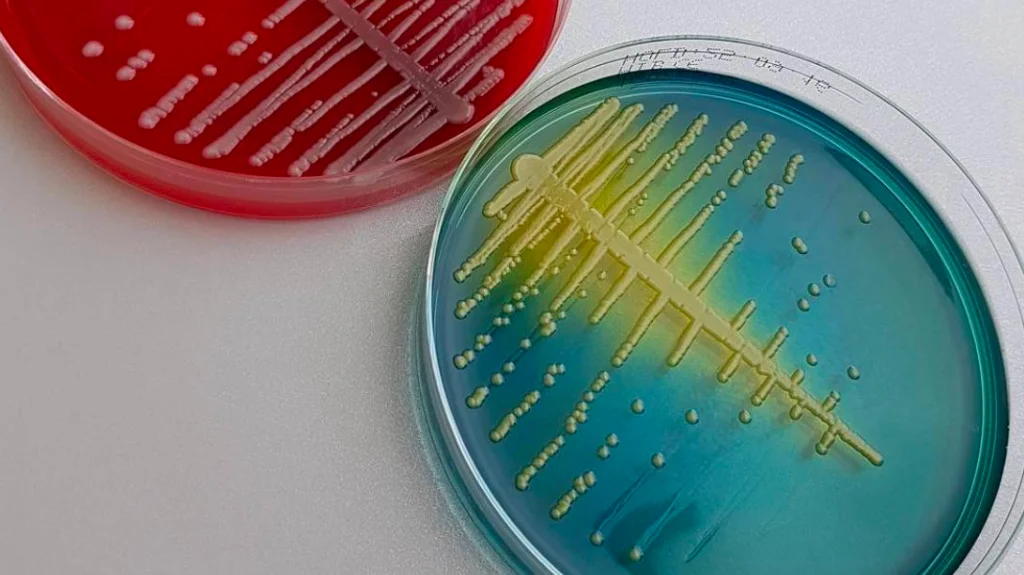 Boyama Setleri : Bilimsel Gelişmeler ve Uygulamalar