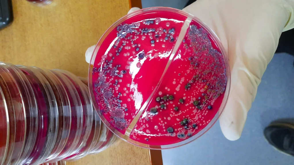 Mikrobiyolojik Besiyerler Hakkında